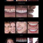 DDS Prada Plata - Casos